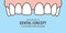 Banner Upper Diastema teeth illustration vector on blue background. Dental concept.