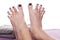 Bare feet with pedicure propped by towel