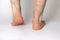 Bare hairy male legs, feet, heels. Achilles tendon.