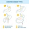 Bariatric surgery weight loss procedure types infographics