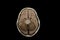 Base of brain model in the skull isolated on black background