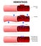 Basic steps in hemostasis