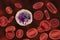 Basophil, a white blood cell