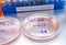 Bat coronavirus ZC45 on petri dish, COVID-19 study in laboratory,