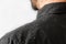 A bearded man in a black shirt, a close up view of the shoulder covered with dandruff. Copy space. The concept of