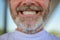 Bearded man with gold fillings giving a toothy smile in close up