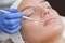 Beautician cleanses the skin on the face from acne and blackheads on the woman`s face in a beauty salon.Treatment of problem skin