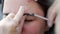 Beautician doctor makes botox injection in the forehead of young beautiful woman. Extreme close up 4k shot