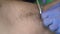 Beautician in gloves cutting long hair in male armpit before sugaring epilation procedure