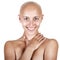 Beautiful bald-headed girl