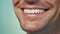 Beautiful mans smile with healthy white, straight teeth close-up on one tone background with space for text