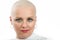 Beautiful middle age woman cancer patient without hair