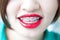 Beautiful smile of atractive woman wearing dental braces.