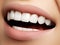 Beautiful smile with whitening teeth. Dental photo. Macro closeu