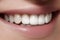 Beautiful smile with whitening teeth. Dental photo. Macro closeup of perfect female mouth, lipscare rutine