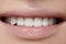 Beautiful smile with whitening teeth. Dental photo. Macro closeup of perfect female mouth, lipscare rutine