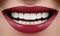 Beautiful Smile with Whitening Teeth. Dental Photo. Macro Closeup of Perfect Female Mouth, Lipscare or Tooth Care Rutine