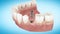 Beautiful Tooth implant installation process. Close Up 3d Animation. Full HD 1920x1080