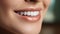 Beautiful wide smile of young fresh woman with great healthy white teeth whitening. Close up Dental image symbolizes oral care