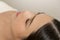 Beautiful Woman Received acupuncture treatment on face by  therapist, chinese medicine treatment, health and healing concept