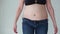 Belly and sides protruding from the female jeans before and after losing weight.