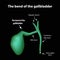 The bend of the gallbladder. Pathology of the gallbladder. Cholecystitis. The structure of the gallbladder. Infographics