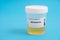 Betaxolol. Betaxolol toxicology screen urine tests for doping and drugs
