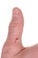 A big dirty finger of a worker with a bloody callus from a shove