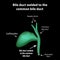 Bile duct welded to the common bile duct. Pathology of the gallbladder. Cholecystitis. The structure of the gallbladder