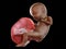 A black fetus