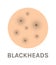 Blackheads. Isolated Black Dots on Skin. Icon. Zoom. Close Up of Skin Problems. Flat Color Cartoon style. White background.