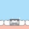 Blank banner lower x-ray healthy hygiene teeth illustration vector design on blue background. Dental care concept