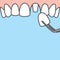 Blank banner Upper Single crown tooth illustration vector on blue background. Dental concept