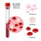 Blood cells research poster with sample in glass flask