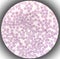 Blood film microscopic show decrease platelets leucocyte (WBC).