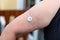 Blood glucose sensor on a woman\'s arm