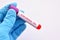 Blood sample tube for influenza A virus subtype H10N3 test