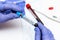 Blood sample tube positive with 2019-nCoV, novel coronavirus 2019 found in Wuhan, China