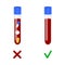 Blood samples with and without drugs. Doping control in sport, post accident drug testing concept. Vector cartoon