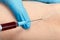 Blood sampling with syringe and needle