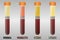 Blood serum common types