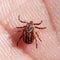 Blood-sucking mite on a human skin macro