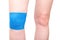 Blue elastic bandage on the knee joint to fix the sore kneecap, white background, isolate. Dislocation