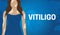 Blue Vitiligo Skin Illness Banner Background