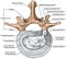 BOARD Lumbar disk herniation