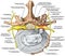 BOARD Stenosis, lumbar disk herniation VS good vertebra