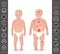 Body of a child, thick and thin , pain points, detailed vector i