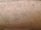 Body hair or Leg hair