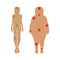 The body of a woman with pain points. Medicine and health, proper nutrition, slimming concepts. Vector illustration