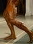 Bodybuilder legs with painfully swollen veins.